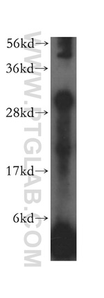 HLA-DRB1 Antibody in Western Blot (WB)
