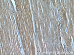 CAP2 Antibody in Immunohistochemistry (Paraffin) (IHC (P))