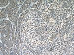 CAP2 Antibody in Immunohistochemistry (Paraffin) (IHC (P))