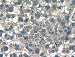 CAP2 Antibody in Immunohistochemistry (Paraffin) (IHC (P))
