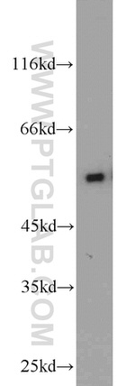 CAP2 Antibody in Western Blot (WB)