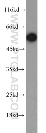 CAP2 Antibody in Western Blot (WB)