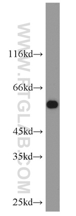 CAP2 Antibody in Western Blot (WB)