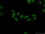 THYN1 Antibody in Immunocytochemistry (ICC/IF)