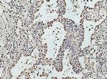 THYN1 Antibody in Immunohistochemistry (Paraffin) (IHC (P))