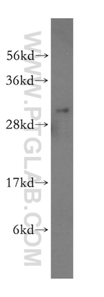 THYN1 Antibody in Western Blot (WB)