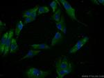 SPANXE Antibody in Immunocytochemistry (ICC/IF)