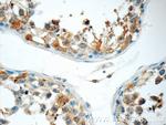 SPANXE Antibody in Immunohistochemistry (Paraffin) (IHC (P))