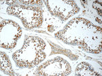 SPANXE Antibody in Immunohistochemistry (Paraffin) (IHC (P))