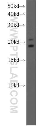 SPANXE Antibody in Western Blot (WB)