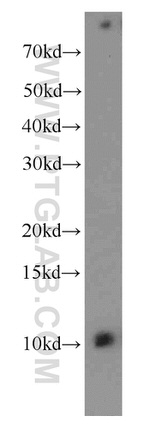 SPANXE Antibody in Western Blot (WB)
