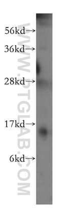 FABP4 Antibody in Western Blot (WB)