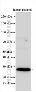 Phospholamban Antibody in Western Blot (WB)