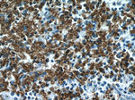 Glycophorin A Antibody in Immunohistochemistry (Paraffin) (IHC (P))
