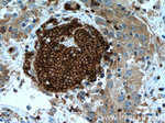 Glycophorin A Antibody in Immunohistochemistry (Paraffin) (IHC (P))