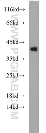 Glycophorin A Antibody in Western Blot (WB)