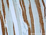 TNNC2 Antibody in Immunohistochemistry (Paraffin) (IHC (P))