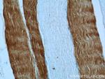TNNC2 Antibody in Immunohistochemistry (Paraffin) (IHC (P))
