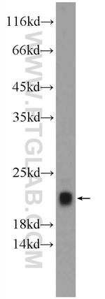 TNNC2 Antibody in Western Blot (WB)