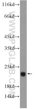 TNNC2 Antibody in Western Blot (WB)