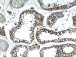 SSX4 Antibody in Immunohistochemistry (Paraffin) (IHC (P))
