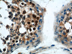 SSX4 Antibody in Immunohistochemistry (Paraffin) (IHC (P))