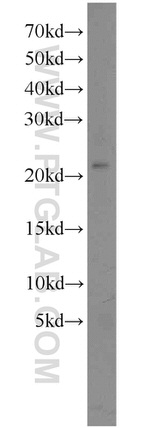 SSX4 Antibody in Western Blot (WB)