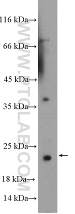 SSX4 Antibody in Western Blot (WB)