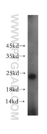 SSX4 Antibody in Western Blot (WB)