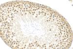 LSM3 Antibody in Immunohistochemistry (Paraffin) (IHC (P))