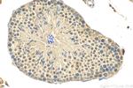 LSM3 Antibody in Immunohistochemistry (Paraffin) (IHC (P))