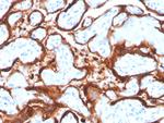 Aromatase/Cytochrome P450 (CYP19A1) Monoclonal Antibody (CYP19A1/4257)