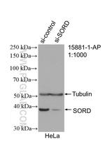 Sorbitol dehydrogenase Antibody in Western Blot (WB)