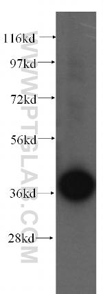 Sorbitol dehydrogenase Antibody in Western Blot (WB)