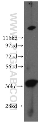 Sorbitol dehydrogenase Antibody in Western Blot (WB)