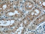 PPP2R1A Antibody in Immunohistochemistry (Paraffin) (IHC (P))