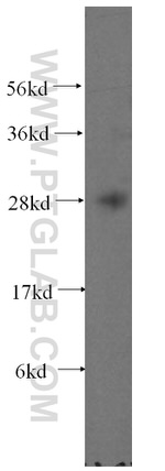 FKBP14 Antibody in Western Blot (WB)