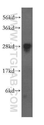 FKBP14 Antibody in Western Blot (WB)