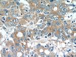 MOBKL3 Antibody in Immunohistochemistry (Paraffin) (IHC (P))