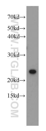 MOBKL3 Antibody in Western Blot (WB)