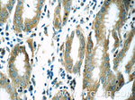 MOBKL3 Antibody in Immunohistochemistry (Paraffin) (IHC (P))