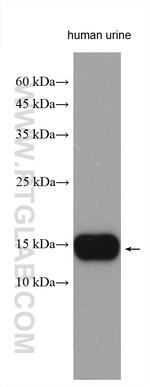 MSMB Antibody in Western Blot (WB)