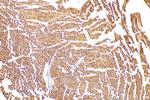 NDUFA2 Antibody in Immunohistochemistry (Paraffin) (IHC (P))