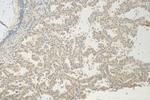 INPP4B Antibody in Immunohistochemistry (Paraffin) (IHC (P))
