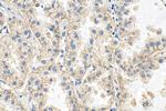 INPP4B Antibody in Immunohistochemistry (Paraffin) (IHC (P))