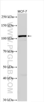 INPP4B Antibody in Western Blot (WB)