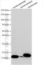 RNASE1 Antibody in Western Blot (WB)