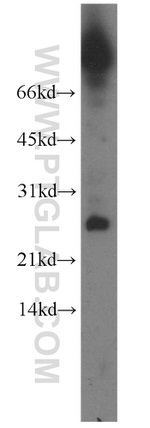 CALML4 Antibody in Western Blot (WB)