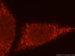 BTN3A3 Antibody in Immunocytochemistry (ICC/IF)