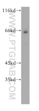 BTN3A3 Antibody in Western Blot (WB)
